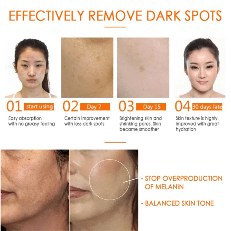 Anti Dark Spots Vitamin C Oil